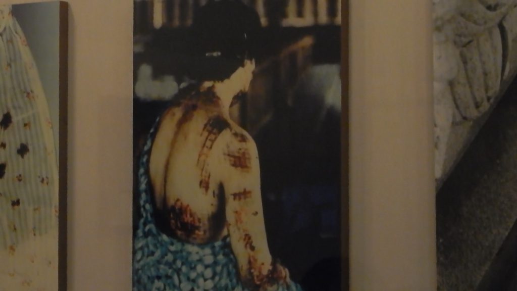 Survivors who wore dark clothes, had the patterns burnt on their skin.